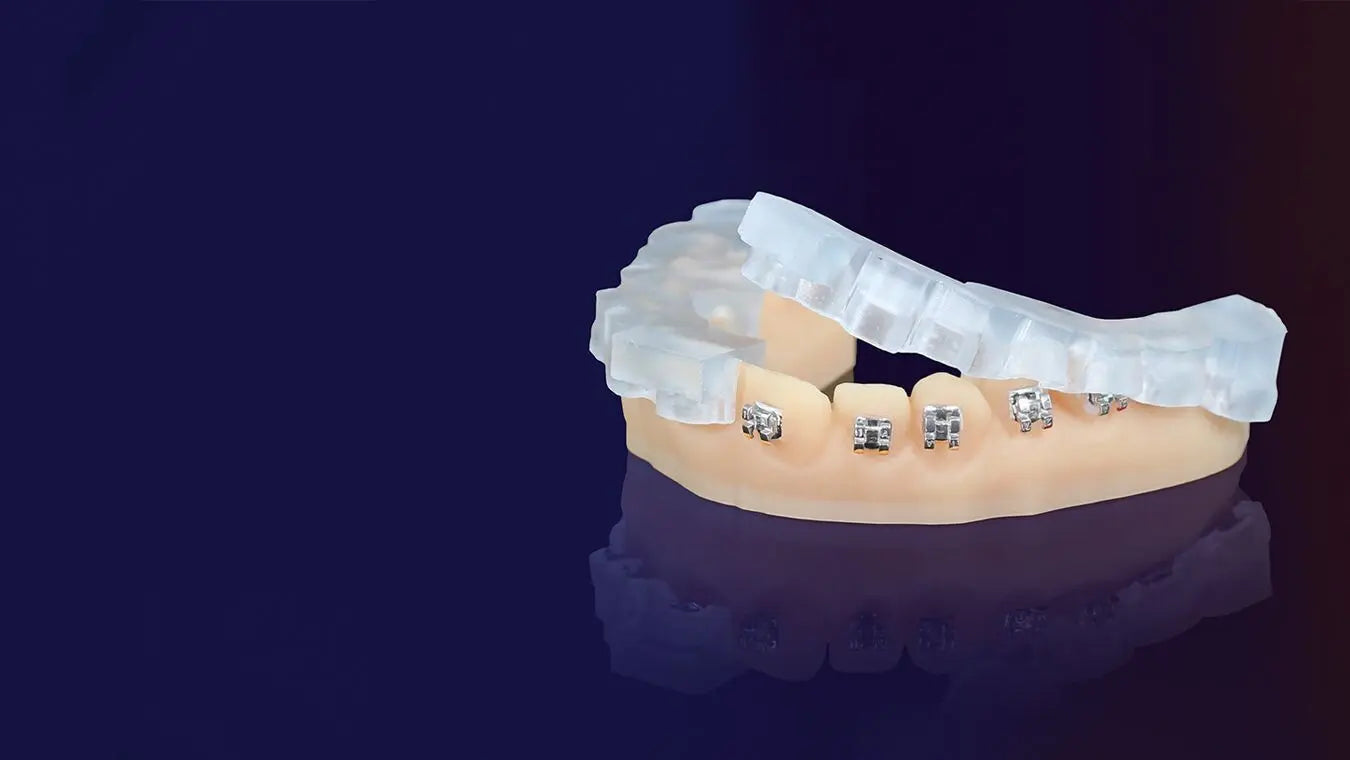 KeyOrtho IBT™ For fabricating indirect bonding trays - RMH3 Digital by RMH3 Dental