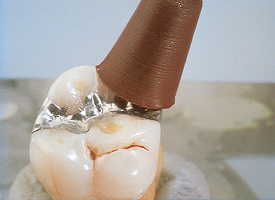 Shofu Greenie Silicone Polisher