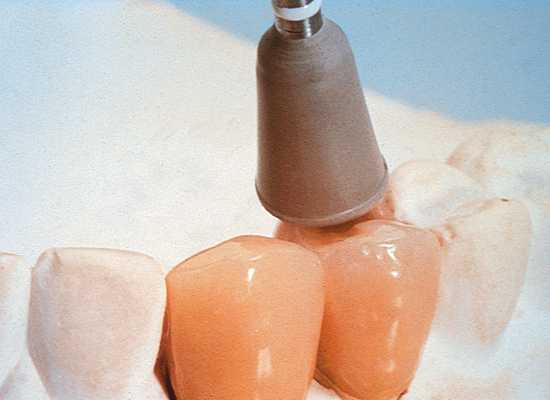 Shofu Ceramisté and Ceramisté Soft 12 Pack