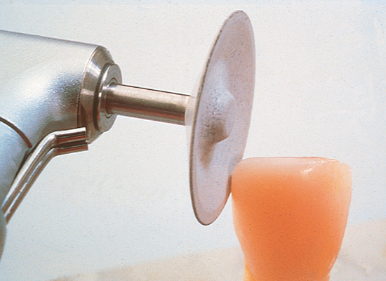 Shofu CompoSite and CompoSite Fine Polishers 12 Pack