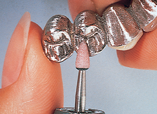 Shofu Lab Series Stones HP