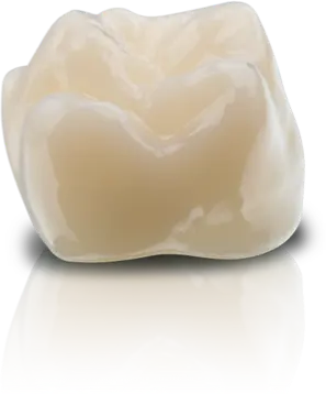 VarseoSmile Crown Plus Permanent Crowns 250g - RMH3 Digital by RMH3 Dental