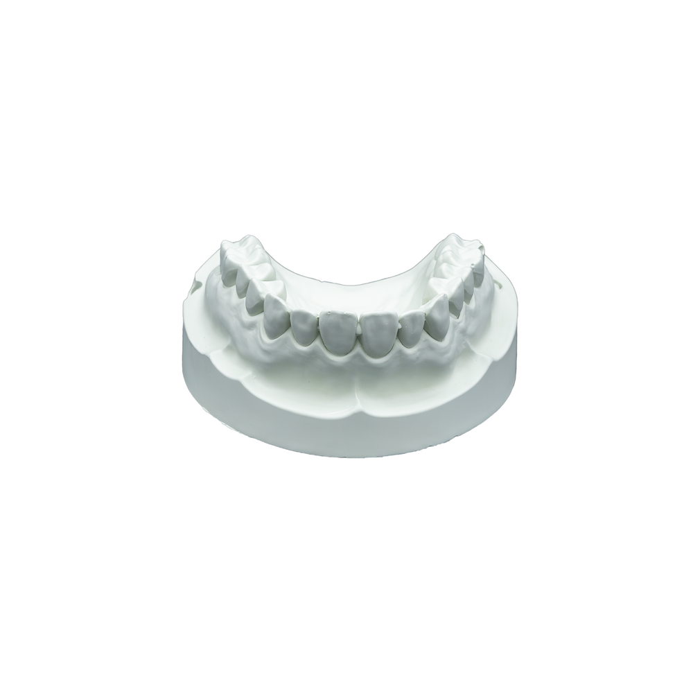 Whip Mix Hard Rock Green ISO Type 5 Dental Die Stone 33 lb / 15 kg