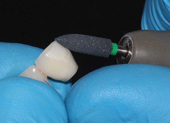 Shofu ZiLMaster 3 Pack