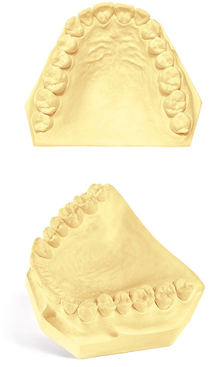 Garreco Pristine III Base Stone Golden, 25 lbs