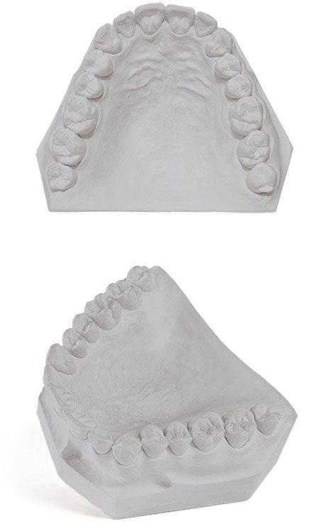 Garreco Mounting Stone Grey 25 lbs