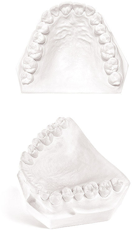 Garreco PLASTER REGULAR 25 LBS