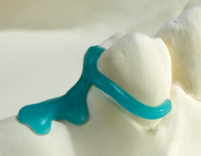 Renfert GEO Premolar Clasps