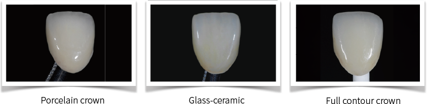 Aidite Stain and Glaze 4g - RMH3 Digital by RMH3 Dental