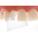 Directa ProxyPal 3D Anterior Matrix thumbnail 4