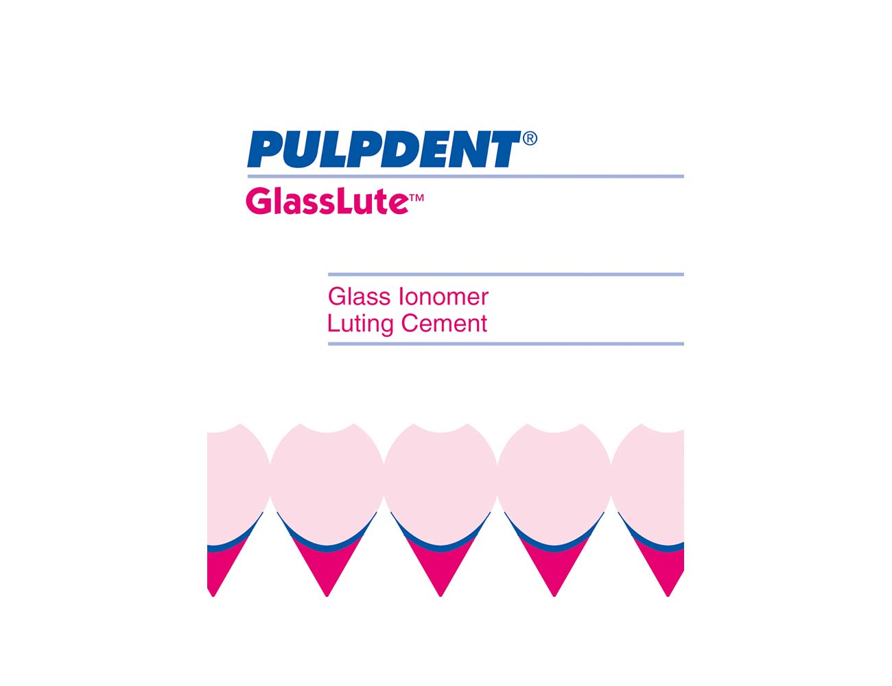 GlassLute™ - PULPDENT