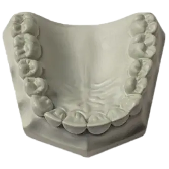 Jade Stone Die Stone High Strength Gypsum 33LB - RMH3 Digital by RMH3 Dental