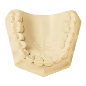 LeanRock Die Stone 33LB - RMH3 Digital by RMH3 Dental