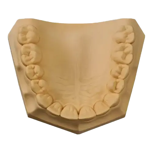 UltiRock Premium Die Stone Gypsum 33LB - RMH3 Digital by RMH3 Dental