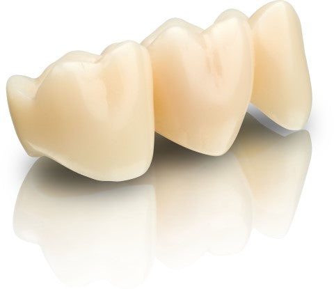 VarseoSmile Temporary Crown and Bridge 3D Resin 250g - RMH3 Digital by RMH3 Dental