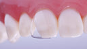Directa CoForm 21 Distal Sectional Matrix thumbnail 3