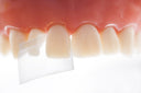Directa ProxyPal 3D Anterior Matrix thumbnail 2