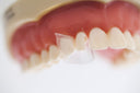 Directa ProxyPal 3D Anterior Matrix thumbnail 3