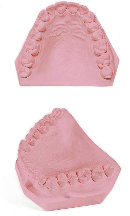 Garreco SATINSTONE TYPE IV - ROSE 50 LBS