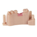 Keystone KeyMask 0.5kg thumbnail 2