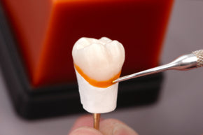 Renfert GEO Expert Cervical Transparen