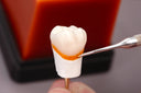 Renfert GEO Expert Cervical Transparen thumbnail 1