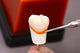 Renfert GEO Expert Cervical Transparen