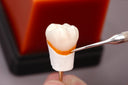 Renfert GEO Expert Cervical Transparen thumbnail 5