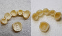 Renfert Temp:ex thumbnail 6
