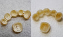 Renfert Temp:ex thumbnail 19