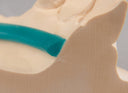 Renfert GEO Lingual Bars, 4 x 2 mm thumbnail 5