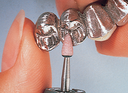 HP Coral Stones thumbnail 5