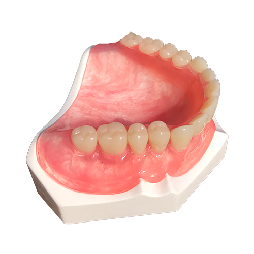 Tcs Thermoplastic Comfort System Sample Model Karadent Full Denture Upper