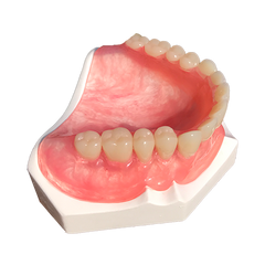 Tcs Thermoplastic Comfort System Sample Model Karadent Full Denture Upper