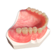 Tcs Thermoplastic Comfort System Sample Model Karadent Full Denture Upper